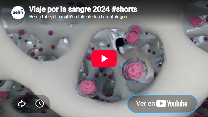 Video sangre